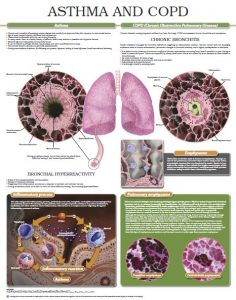 Asthama-COPD