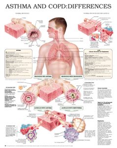 Asthma-and-COPD-differences