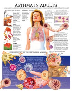 Asthma-in-adults