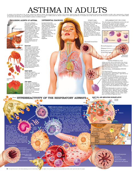 Asthma-in-adults