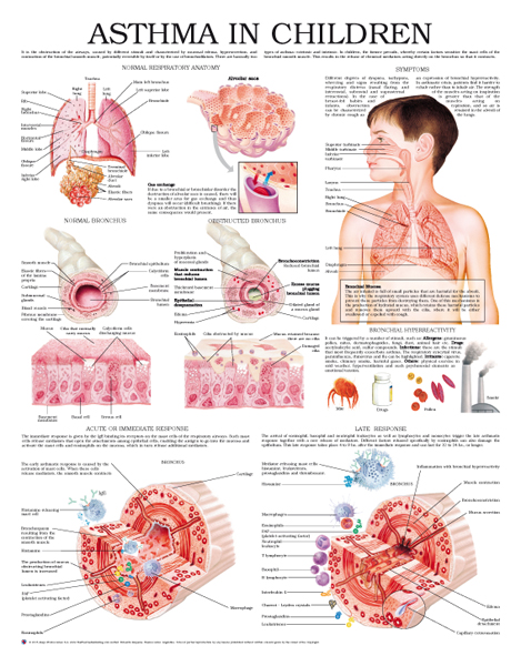 Asthma-in-infants