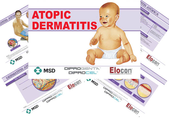 Atopic-dermatitis-Elocon-Diprogenta-Diprogel-MSD