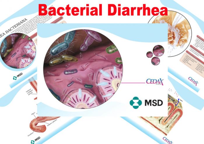 Bacterial-Dhiarreae-Cedax-MSD
