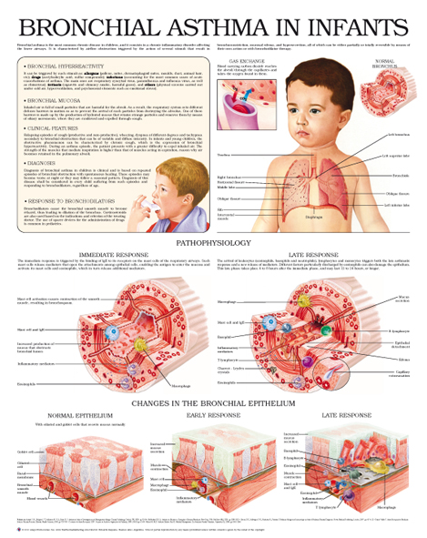 Bronchial-asthma-in-infants