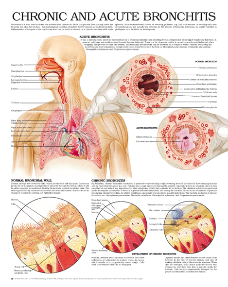 Chronic-and-acute-bronchitis