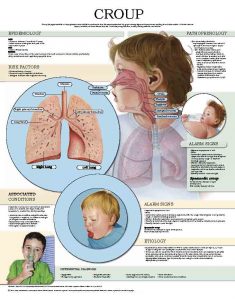 Croup