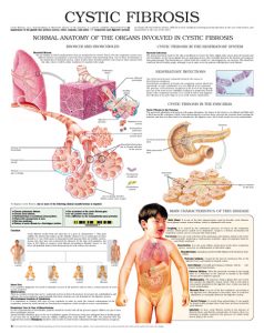 Cystic-fibrosis