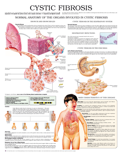 Cystic-fibrosis