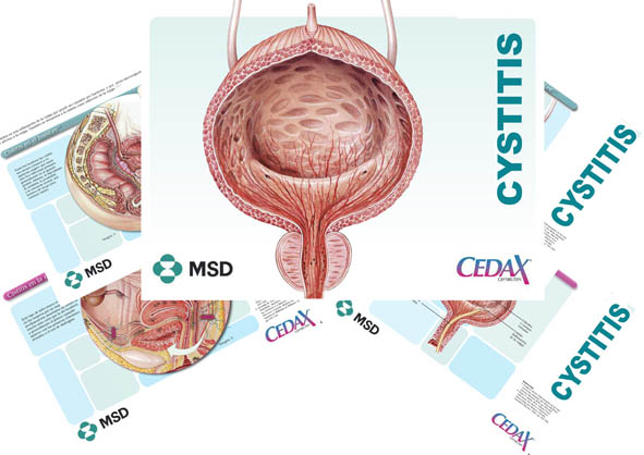 Cystitis-Cedax-MSD