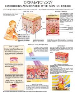 Disorders-associated-with-sun-exposure1