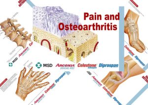 Pain-and-Osteoarthritis-MSD-arcoxia-celestone-diprospan