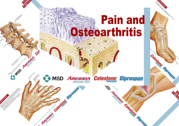 Pain-and-Osteoarthritis-MSD-arcoxia-celestone-diprospan
