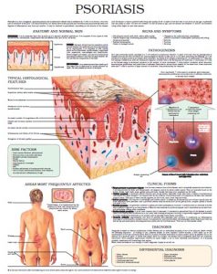 Psoriasis