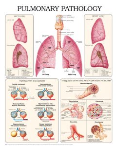 Pulmonary-pathology