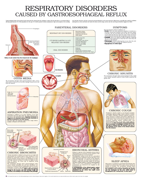 Respiratory-disorders-caused-by-gastroesophageal-reflux