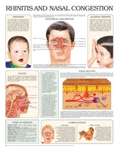 Rhinitis-and-nasal-congestion