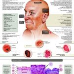 Skin-Cancer