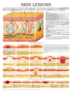 Skin-Lesions