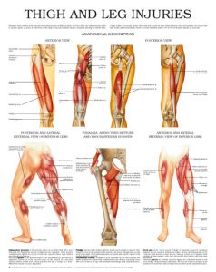 Thigh-and-leg-injuries
